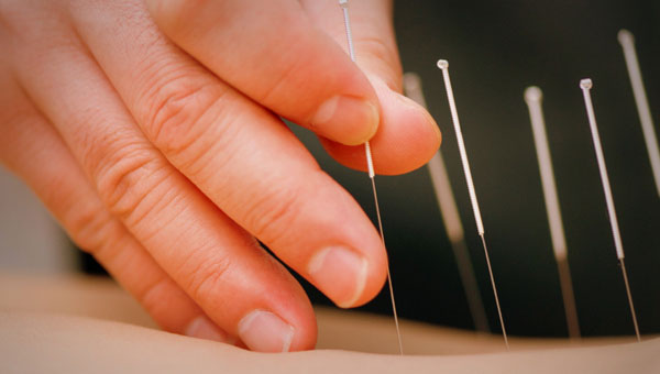 Pontos da acupuntura para emagrecer